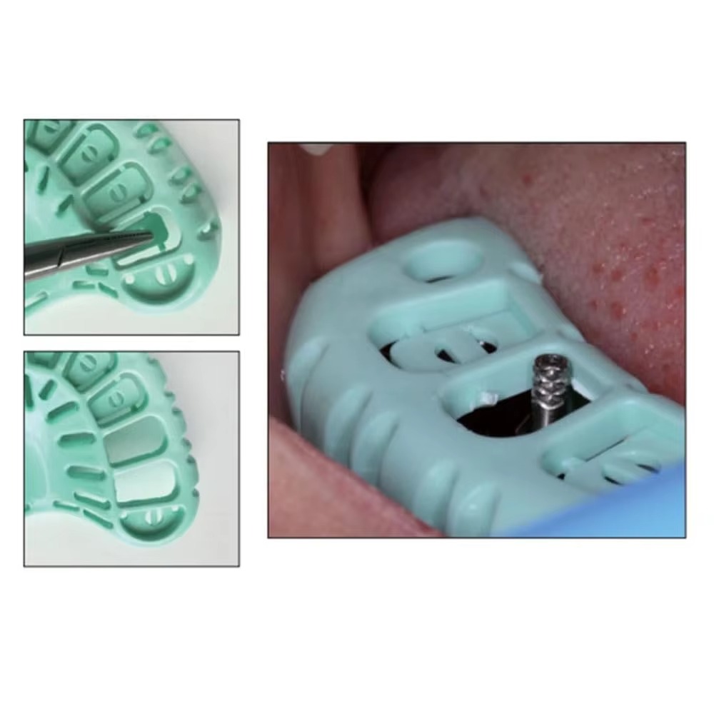 FULAIGE 6Pcs/Set Disposable De - Dental Impression Material Kit 评论和价格