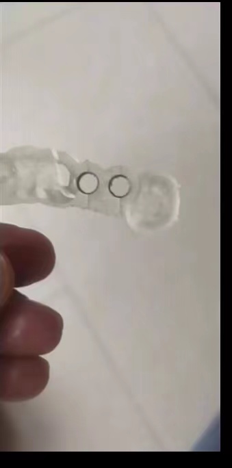 Resin Dental 3D Printer Planti - Dental 3D Printer Resin 评论和价格