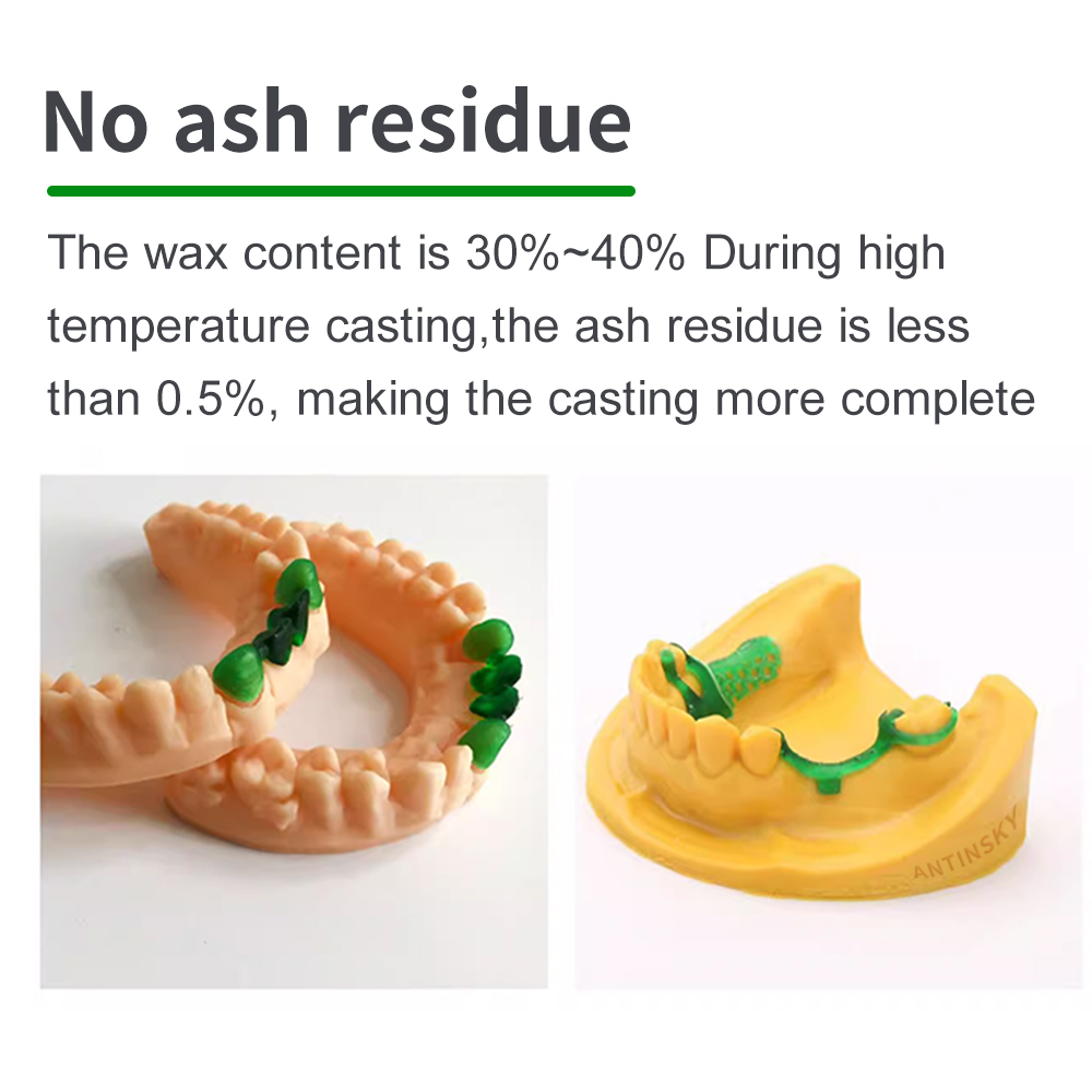 Antinsky Castable Dental Smart - Dental 3D Printer Resin 评论和价格