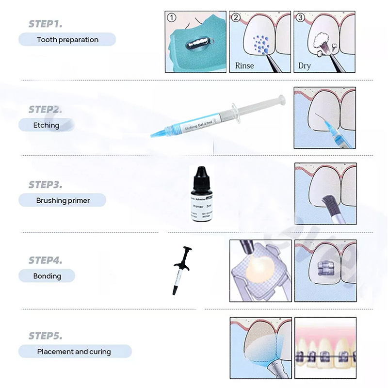 Dental Light Curing Orthodonti - Dental Impression Material Kit 评论和价格